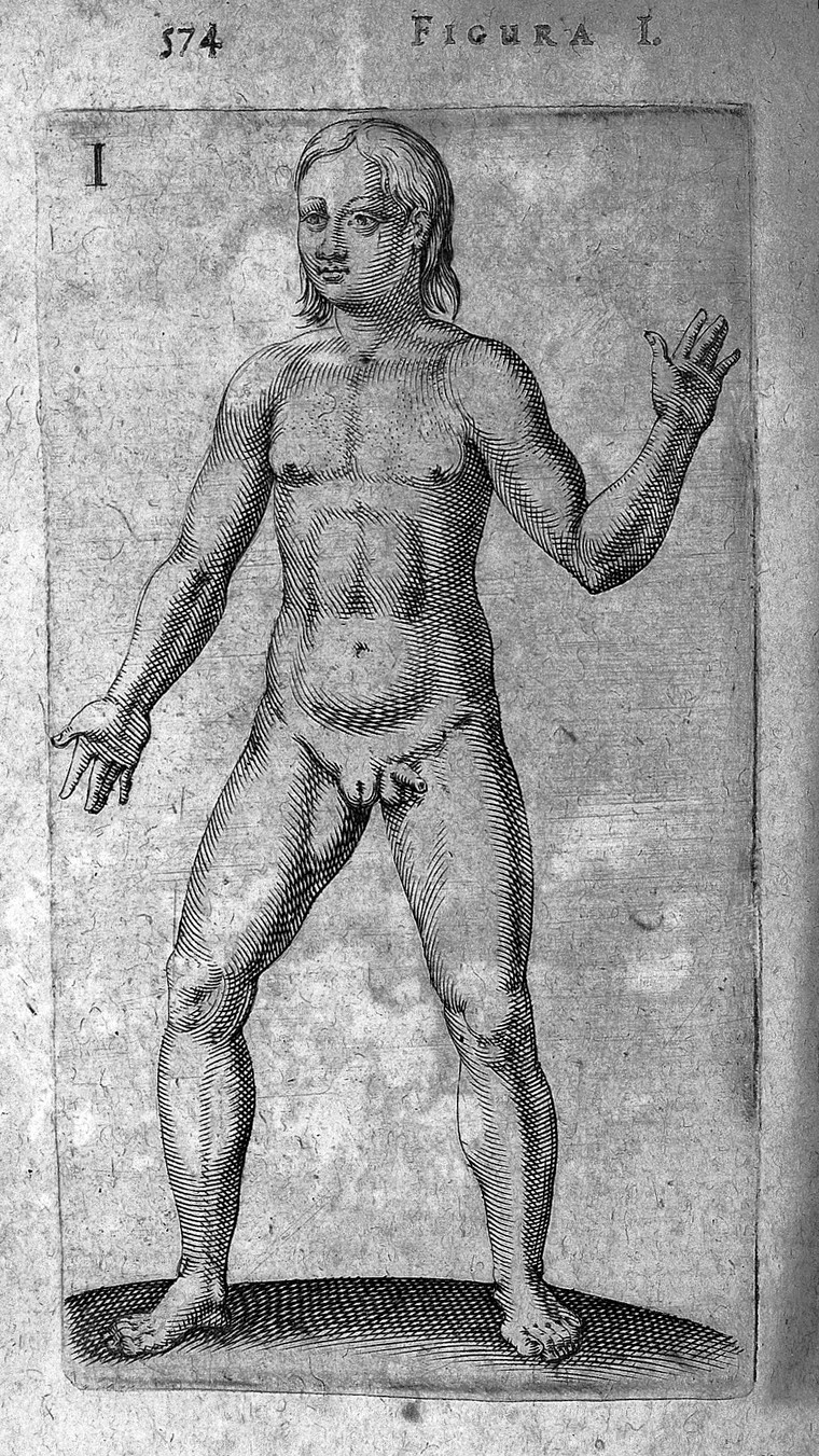 Hermaphrodite from De Hermaphroditorum, 1614' by Thomas de Bry. 